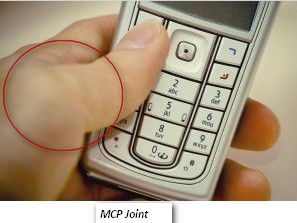 MCP Joint in Texting